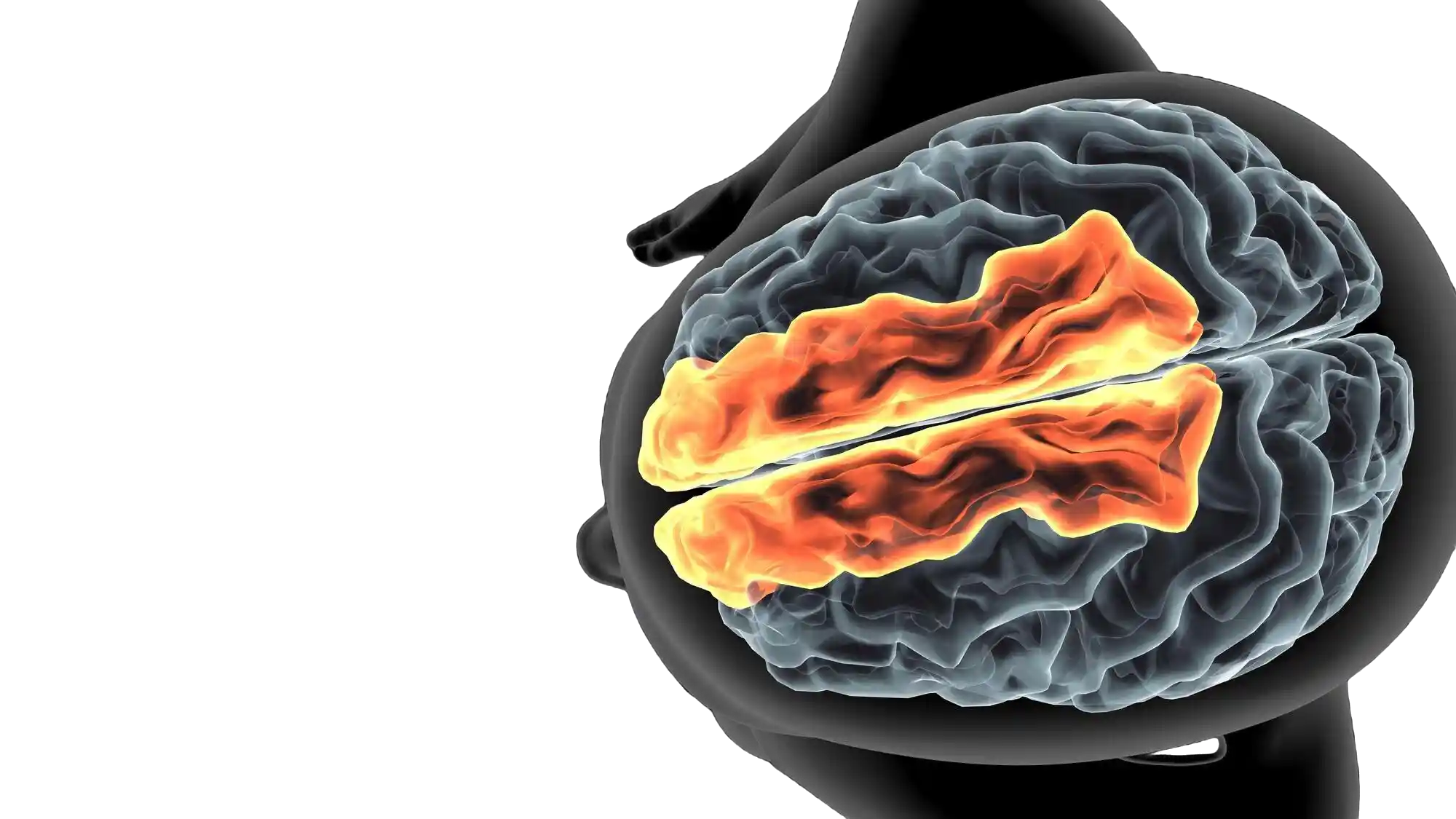 Stroke Illustration