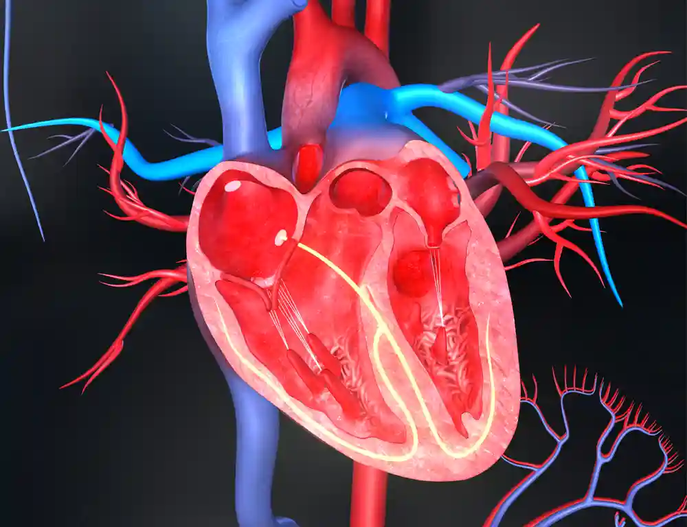 Structural Heart Disease Illustration
